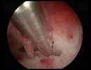arcuate
