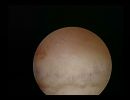 arcuate fundus